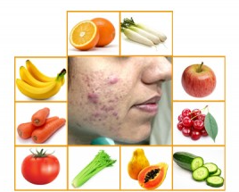 Fruits that are suitable for acne-prone skin